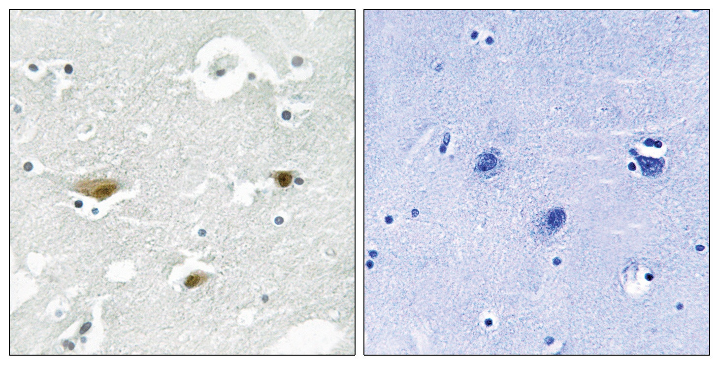STK39 (phospho Ser325) Antibody