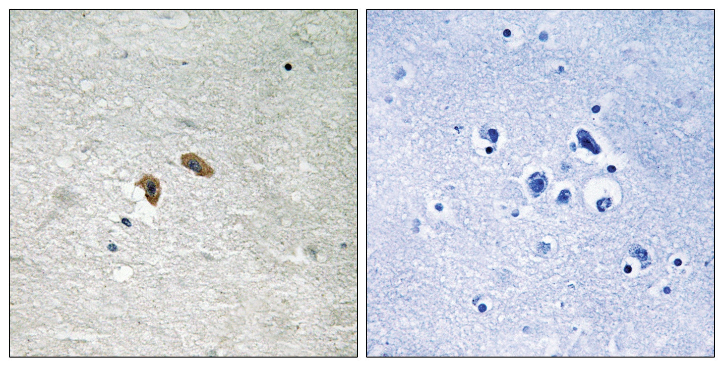 C-RAF (phospho Thr269) Antibody