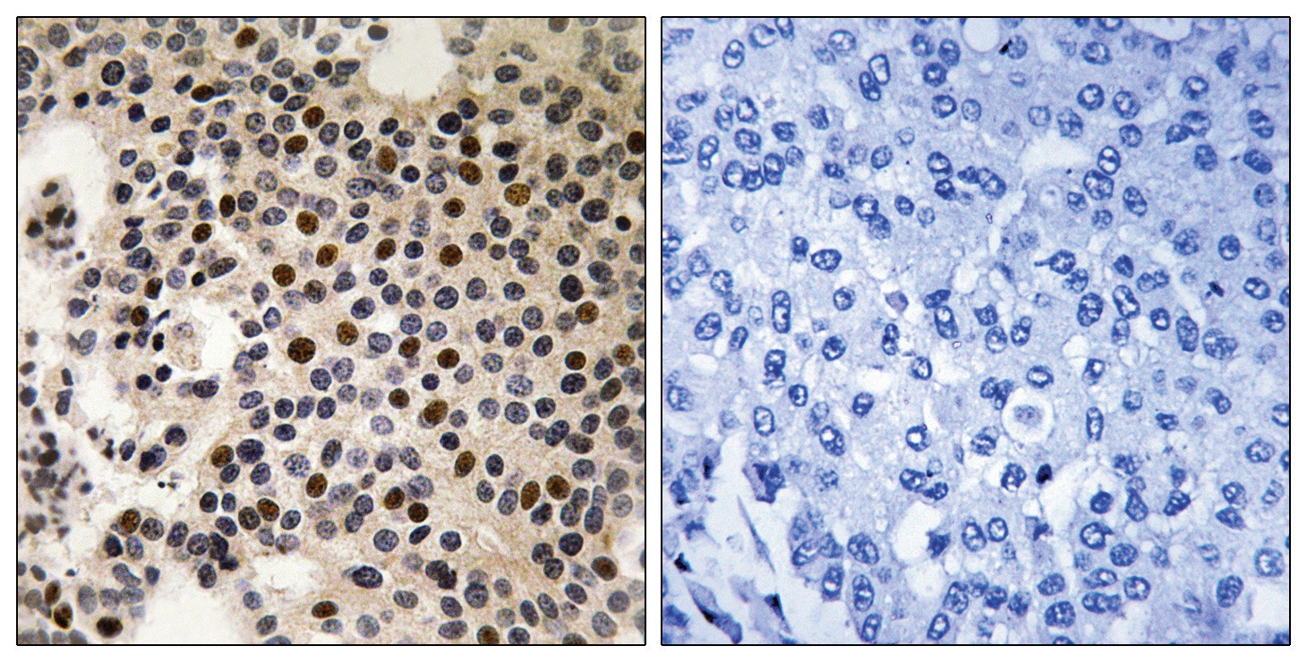 PAK2 (phospho Ser197) Antibody