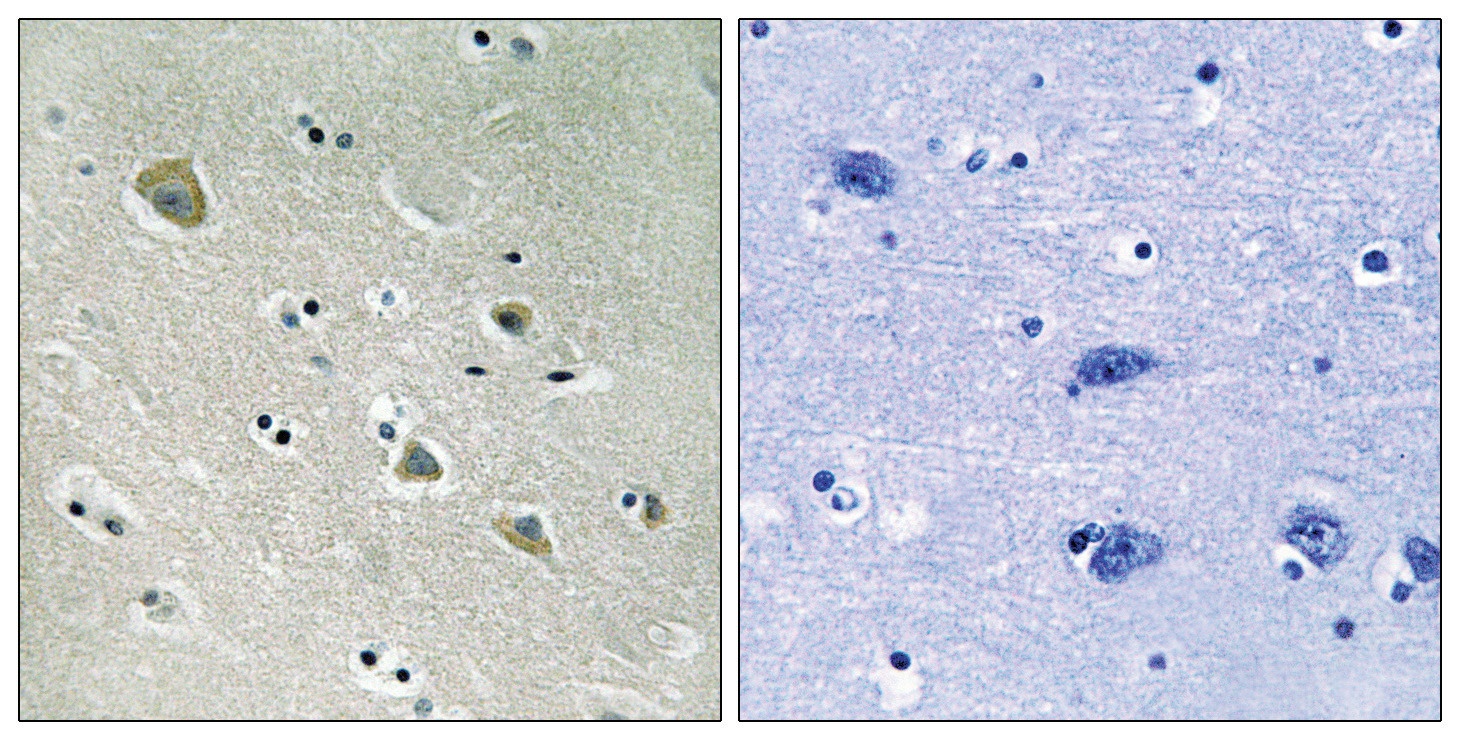 PAK1 (phospho Ser204) Antibody