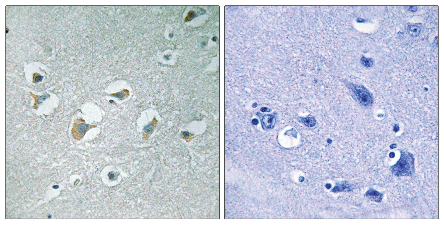 MLK1/2 (phospho Thr312/266) Antibody