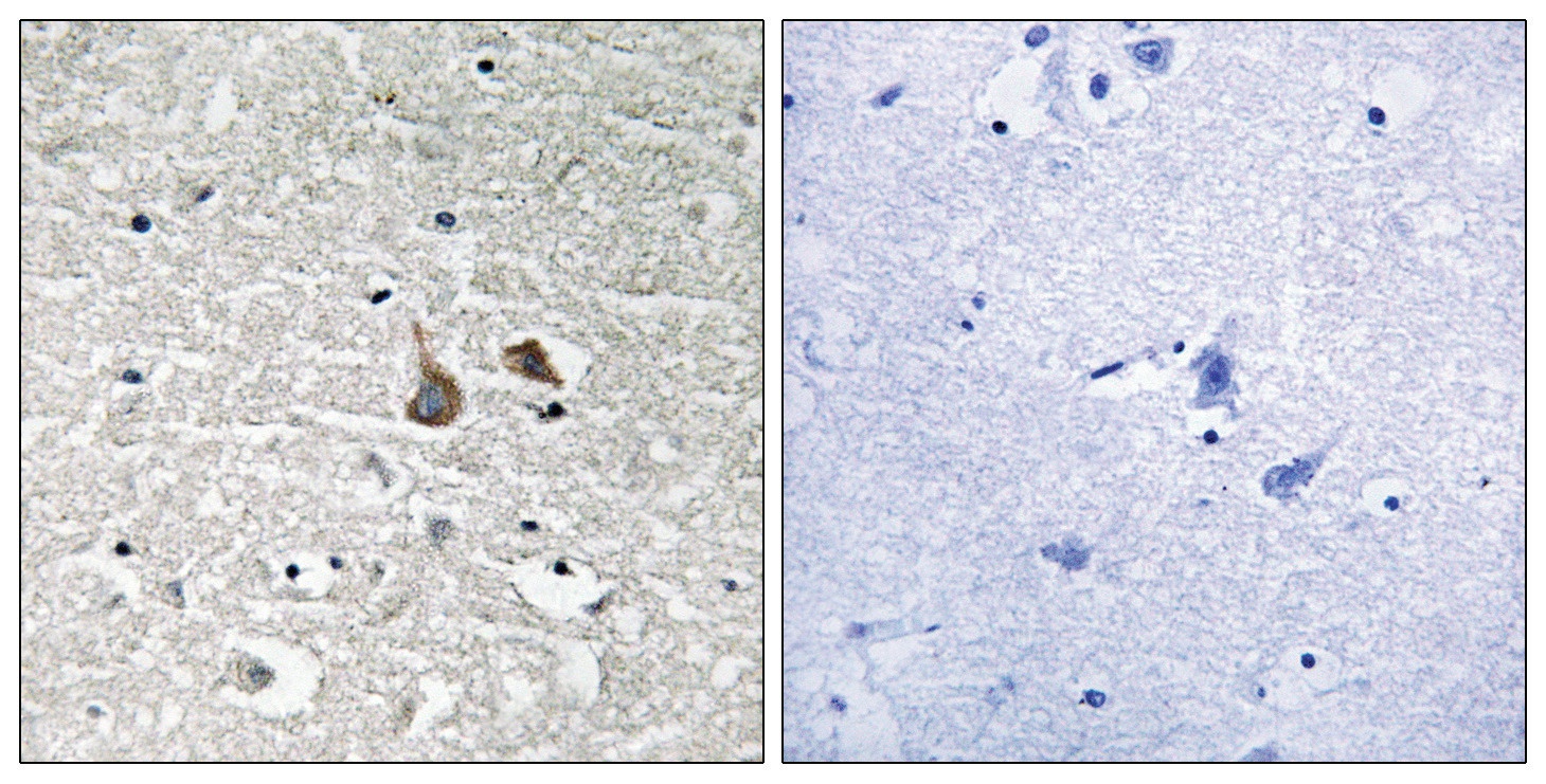 IRAK1 (phospho Ser376) Antibody