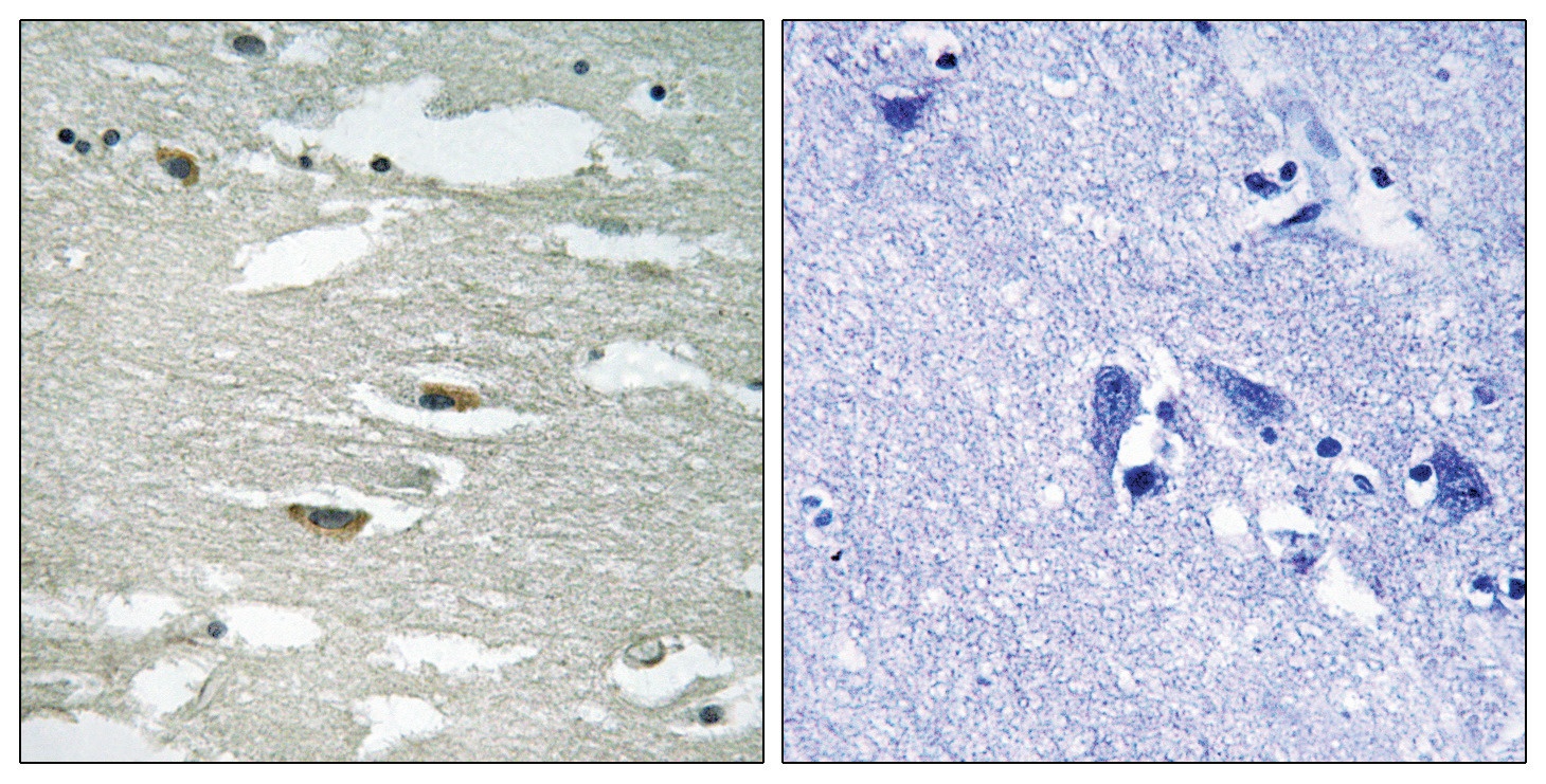ILK (phospho Ser246) Antibody