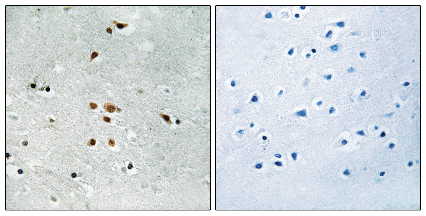 FER (phospho Tyr402) Antibody