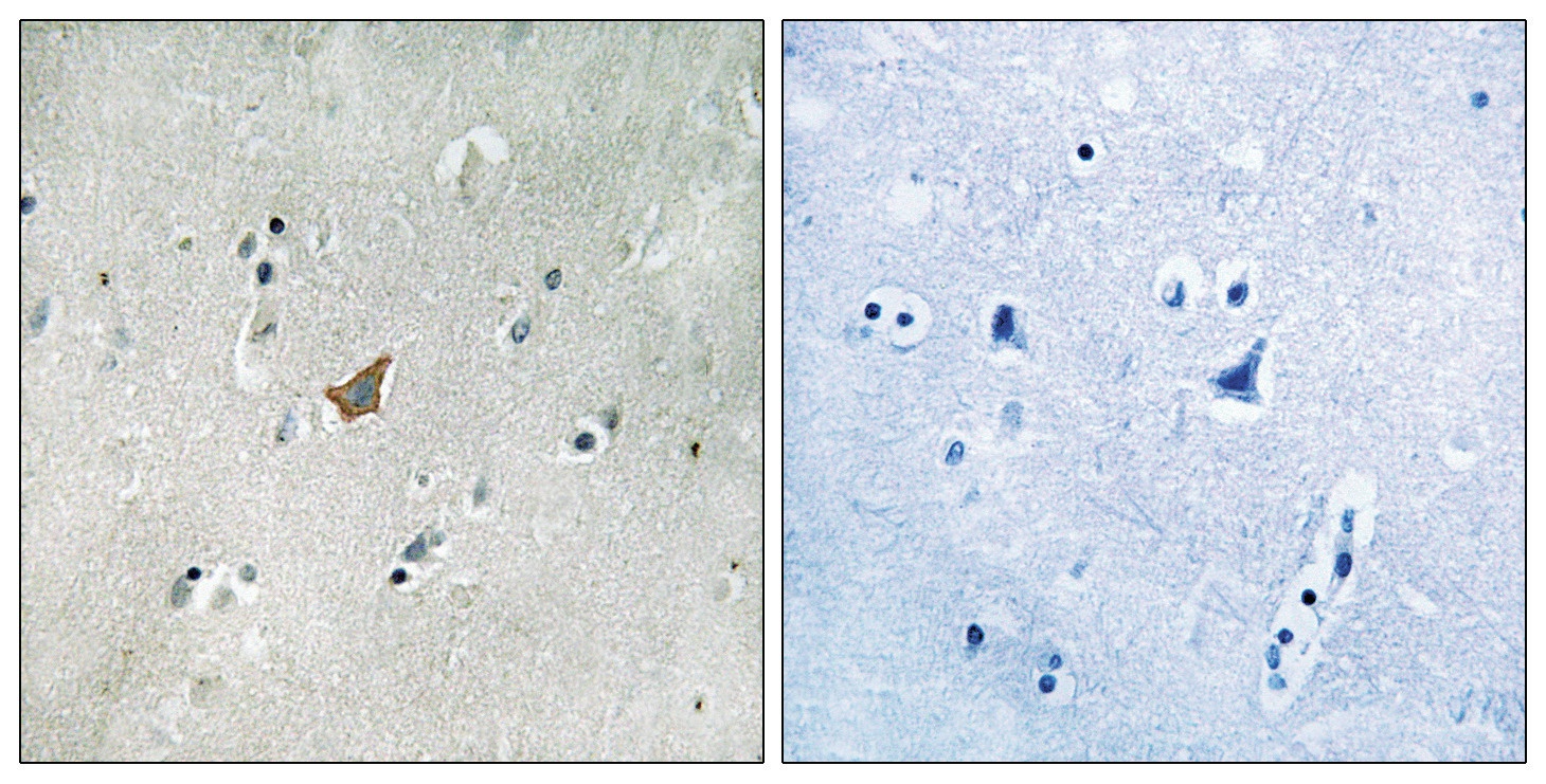 EPHA3/4/5 (phospho Tyr779/833) Antibody