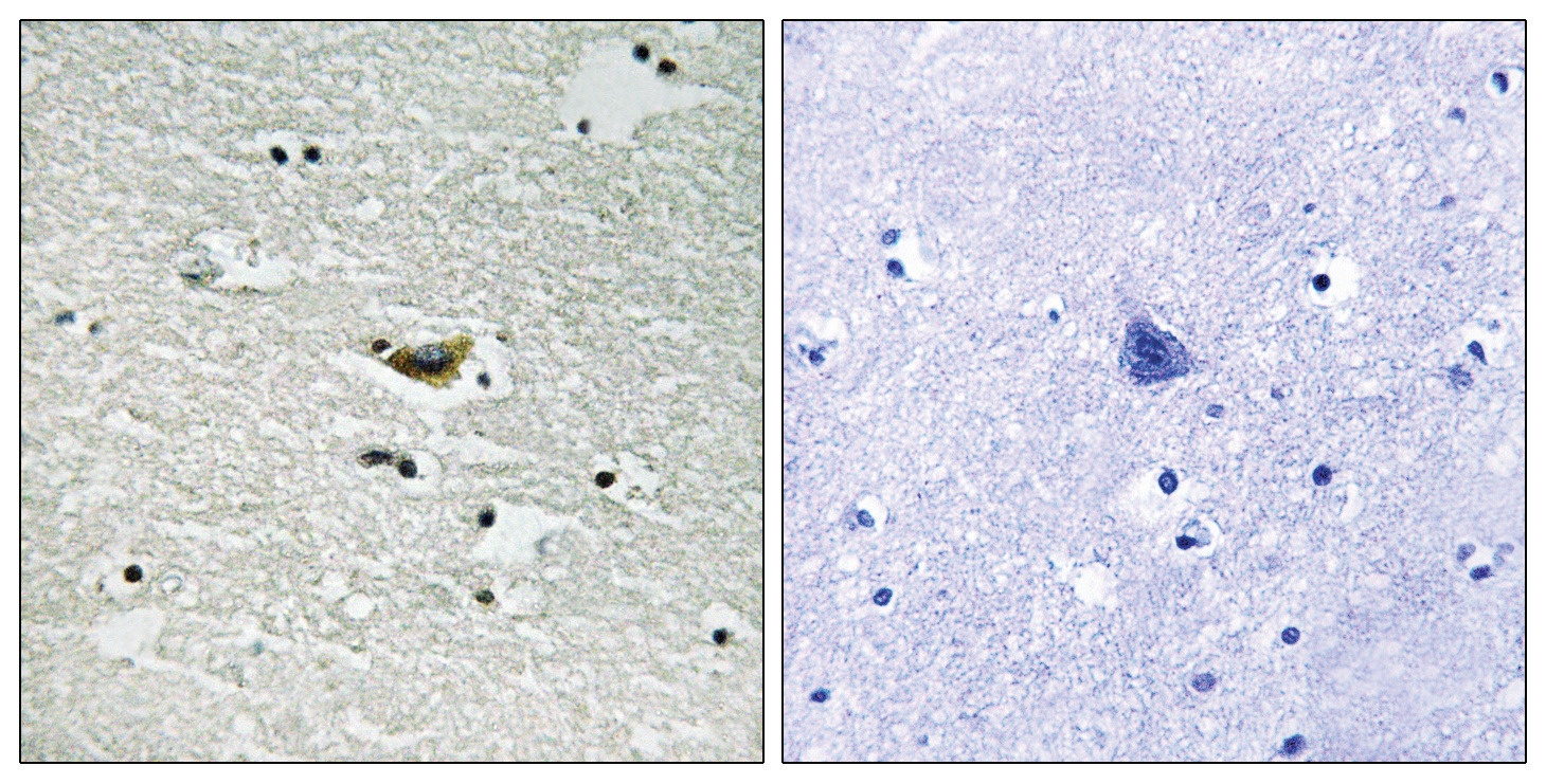 CK-1alpha (phospho Tyr294) Antibody