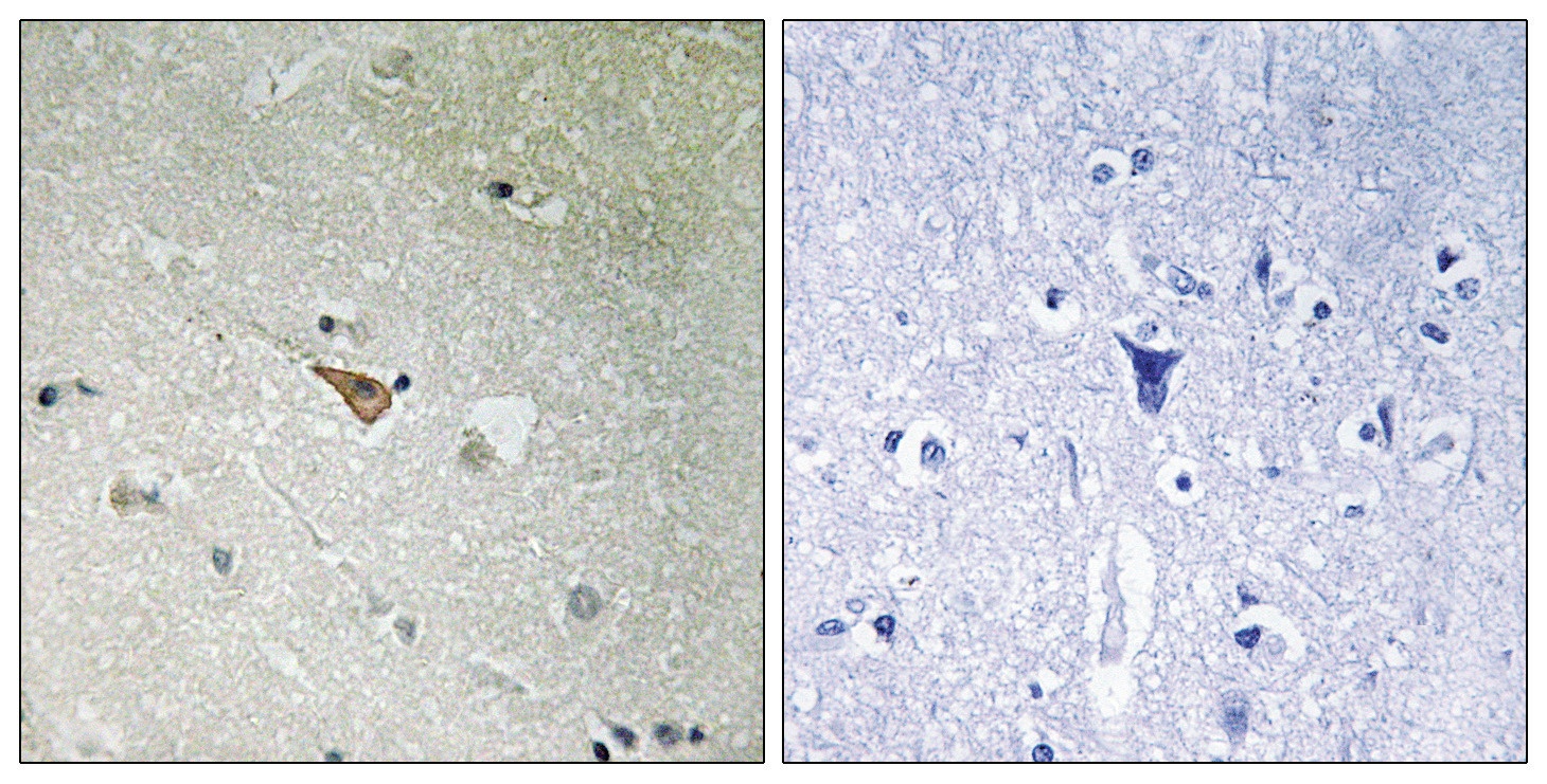 ALK (phospho Tyr1096) Antibody