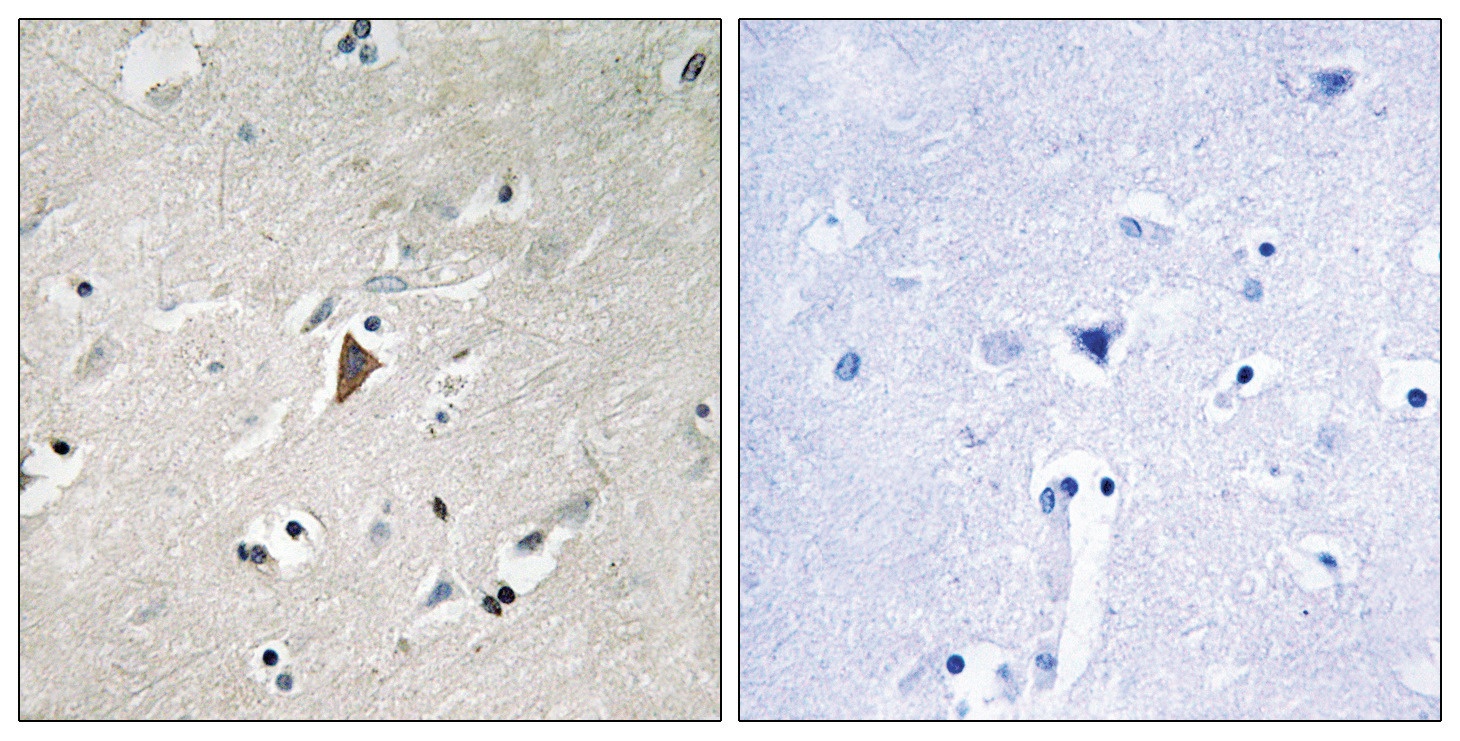 PDK1 (phospho Tyr9) Antibody