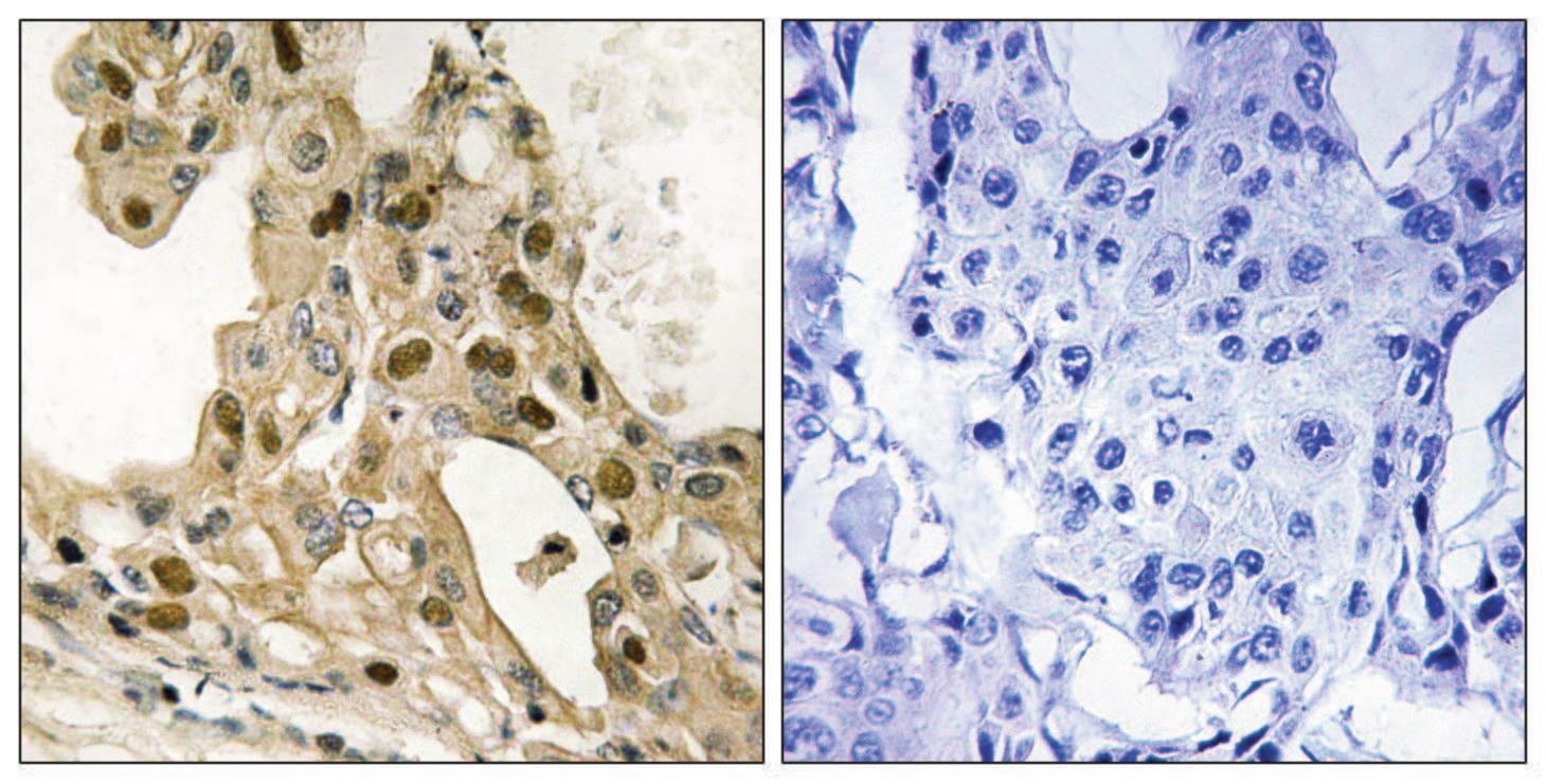p53 (phospho Thr387) Antibody