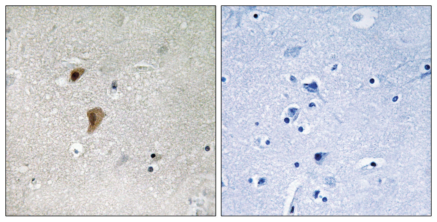 HSF1 (phospho Thr142) Antibody