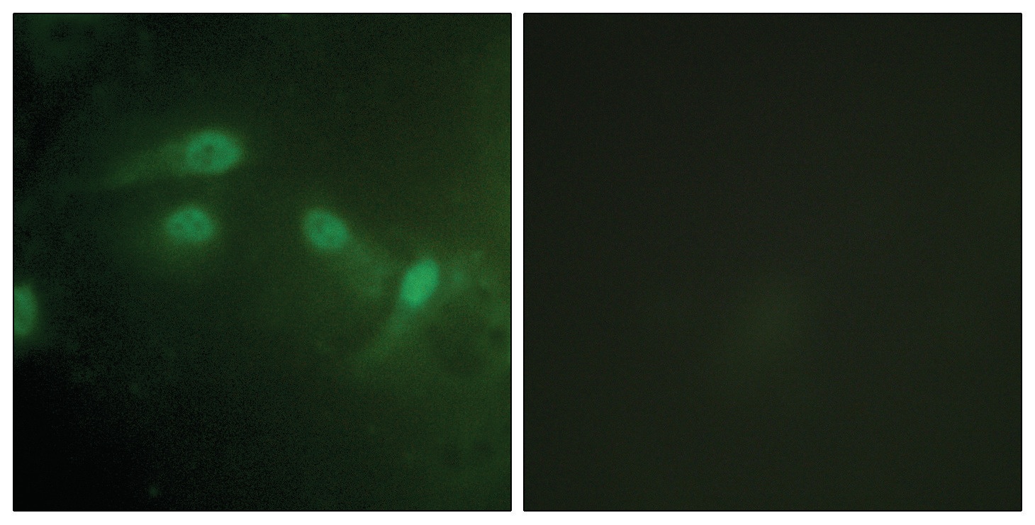 MDM2 (phospho Ser186/Ser188) Antibody