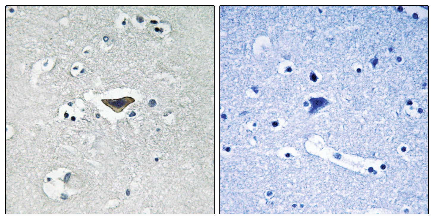 Ras-GRF1 (phospho Ser916) Antibody
