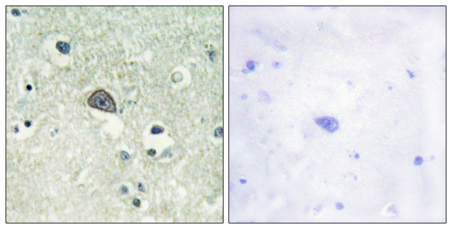 NMDAR1 (phospho Ser890) Antibody