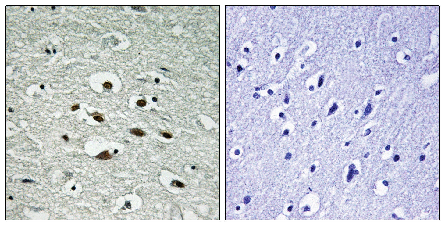 Chk1 (phospho Ser296) Antibody