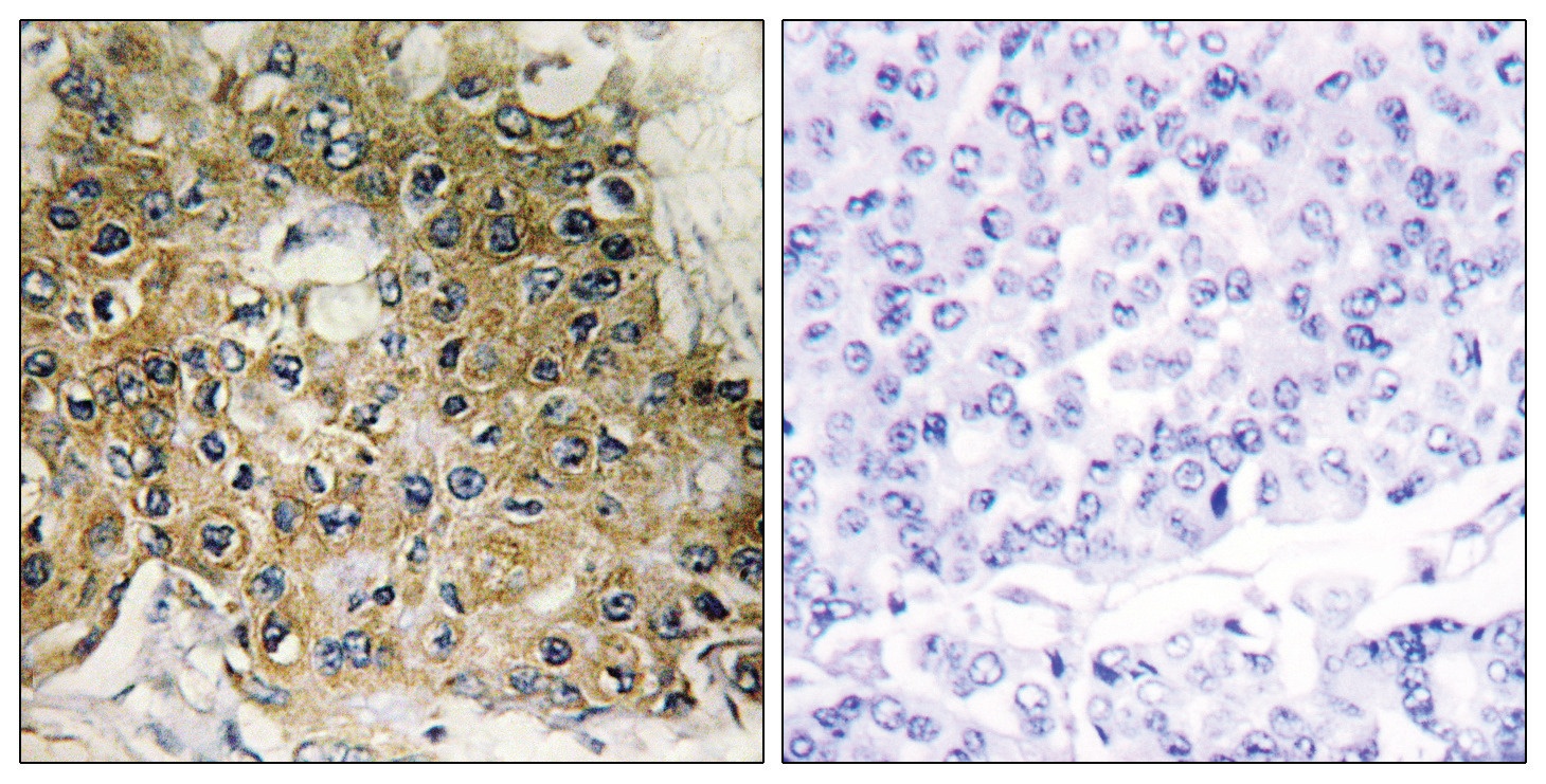 Integrin beta1 (phospho Thr789) Antibody