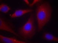 NFkB p105 / p50 (Ab 927) Antibody