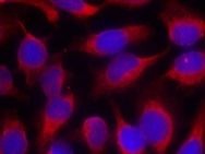 MARCKS (Ab 158) Antibody