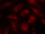 p70 S6 Kinase (Ab 389) Antibody