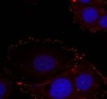 FAK (phospho Tyr576 / Tyr577) Antibody