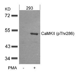 CaMKII (phospho Thr286) Antibody