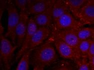 a Synuclein (phospho Tyr136) Antibody