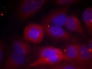 Tyrosine Hydroxylase (phospho Ser40) Antibody