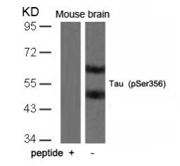 Tau (phospho Ser356) Antibody