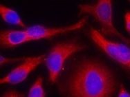 PKD / PKCmu (phospho Ser738) Antibody
