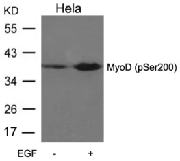 MyoD (phospho Ser200) Antibody
