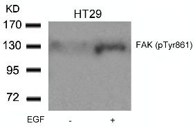 FAK (phospho Tyr861) Antibody