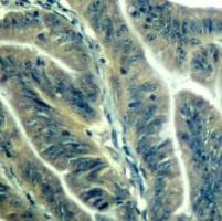 CDK6 (Ab 24) Antibody