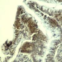 CDK6 (Ab 13) Antibody