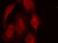 CDK6 (Ab 13) Antibody