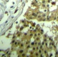 CDC2 (Ab 19) Antibody