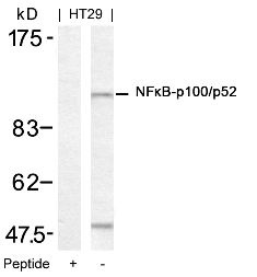 NFkB p100 / p52 (Ab 872) Antibody