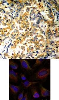 NFkB p100 / p52 (Ab 872) Antibody