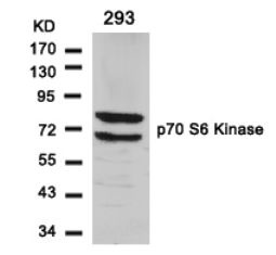 p70 S6 Kinase (Ab 411) Antibody