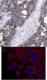 p70 S6 Kinase (Ab 411) Antibody