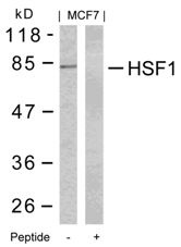 HSF1 (Ab 303) Antibody