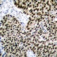 HSF1 (Ab 303) Antibody