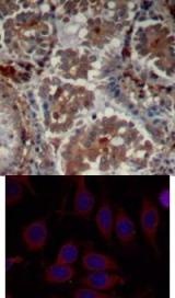 mTOR (Ab 2448) Antibody