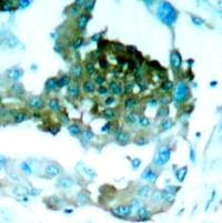 PKCtheta (Ab 695) Antibody