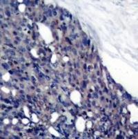 IkB a (Ab 42) Antibody