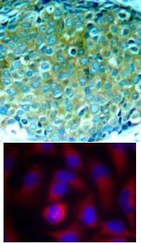 PAK1 (Ab 212) Antibody