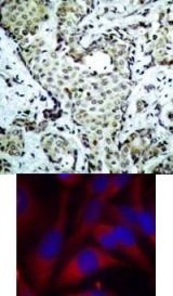 MKK6 (Ab 207) Antibody
