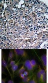 FAK (Ab 925) Antibody