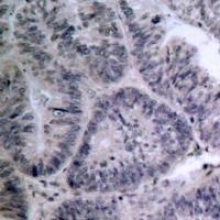 IKK a (Ab 23) Antibody