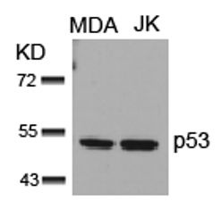p53 (Ab 15) Antibody