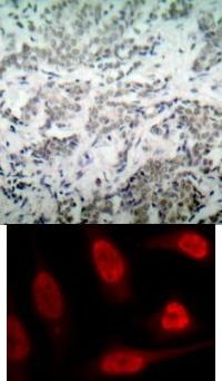 p53 (Ab 15) Antibody