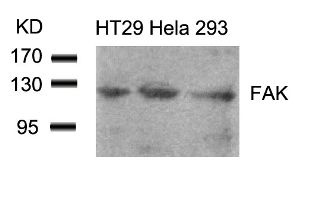FAK (Ab 861) Antibody